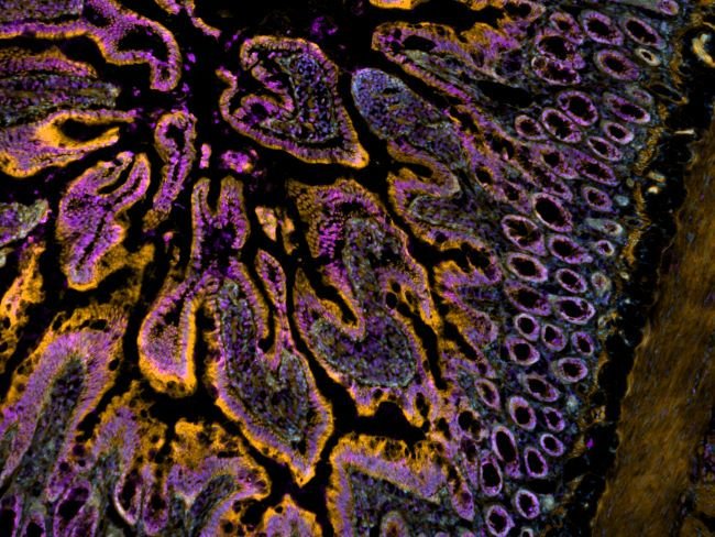 CellMask Orange Actin Tracking Stain labeling in IHC protocol
